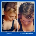 MOEA - Basis – Set - Anti-haarausfall + Haarbürste als Geschenk