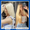 MOEA - Basis – Set - Anti-haarausfall + Haarbürste als Geschenk
