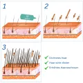 MOEA - Basis – Set - Anti-haarausfall + Haarbürste als Geschenk