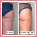 Complex gegen Cellulite und Fett + Körperformendes Körperpeeling mit Koffein als Geschenk dazu