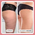 Complex gegen Cellulite und Fett + Körperformendes Körperpeeling mit Koffein als Geschenk dazu